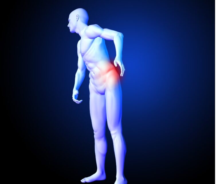 sciatica pain Coventry