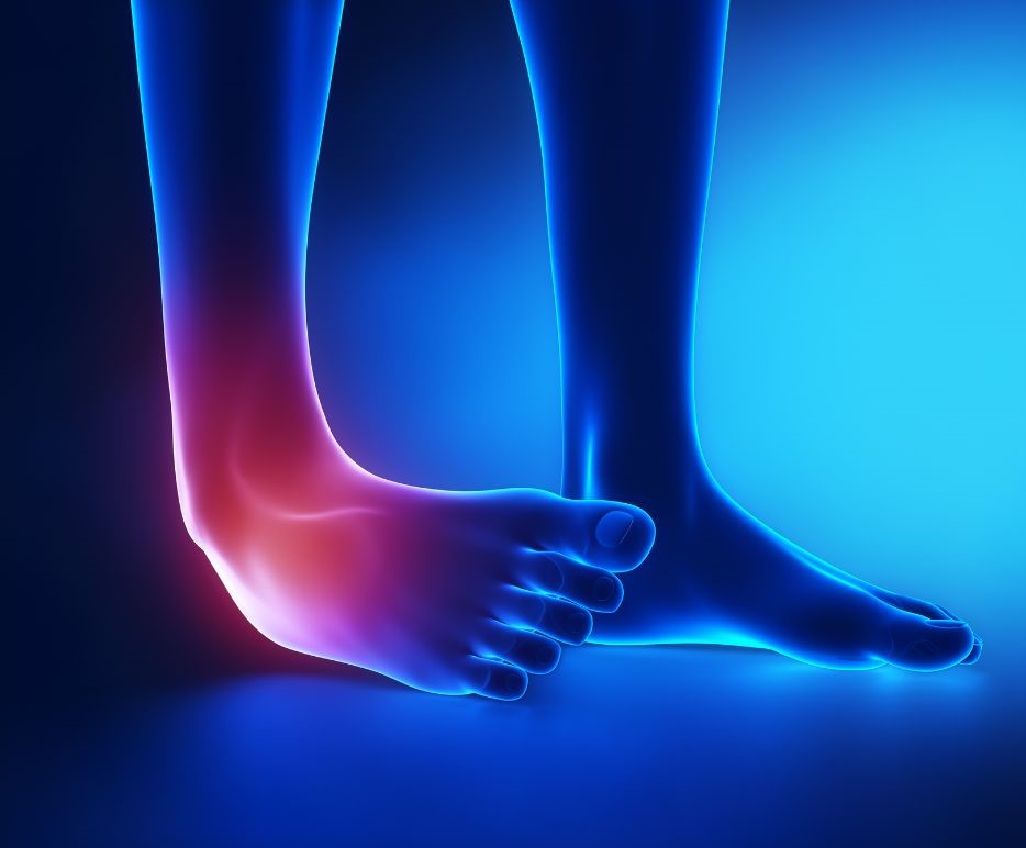 ankle injuries in Coventry and the Midlands