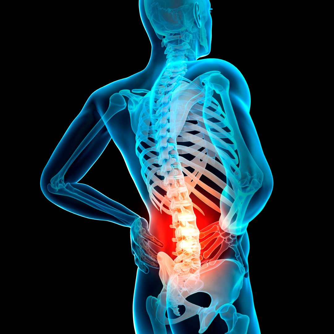 back pain (1)