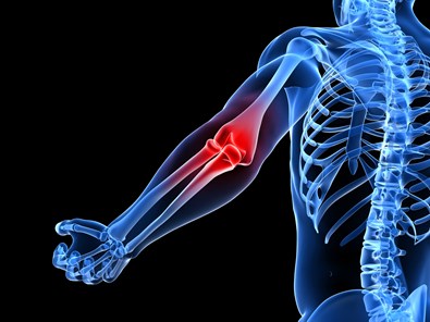 Golfer's elbow in Coventry and the Midlands