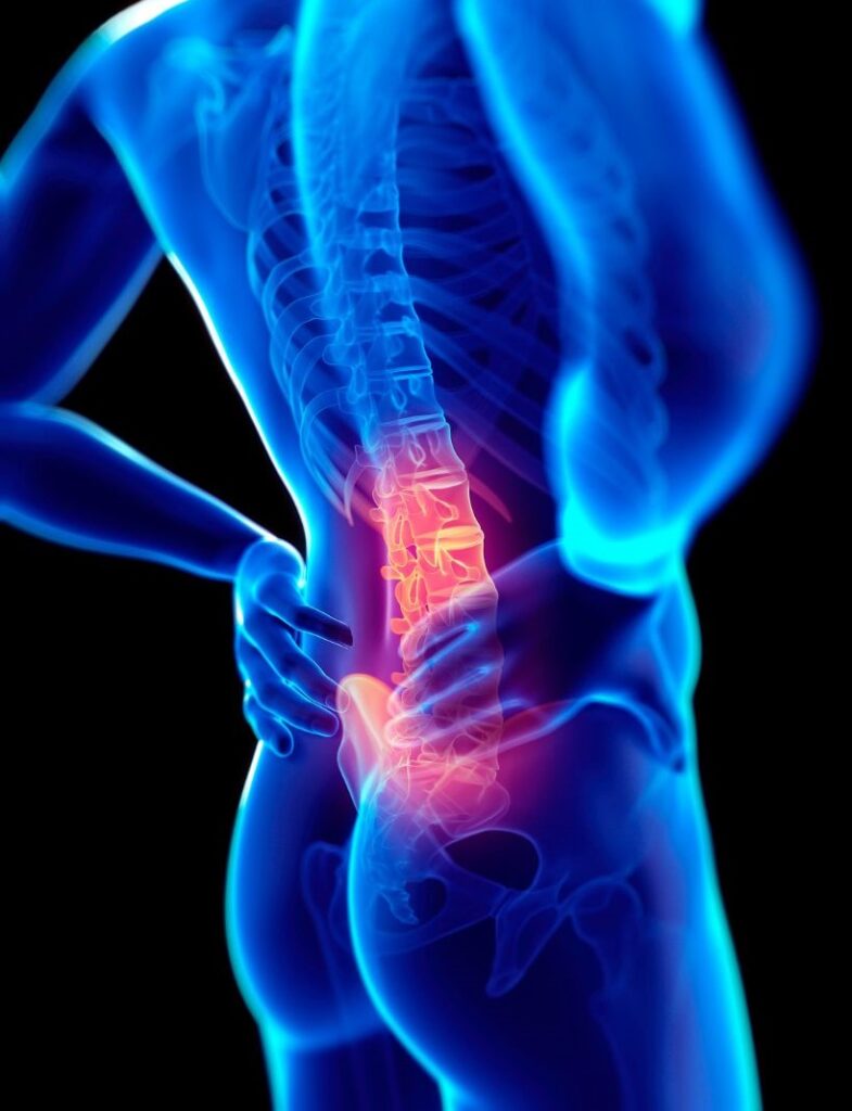 Sciatica pain in Coventry and the Midlands