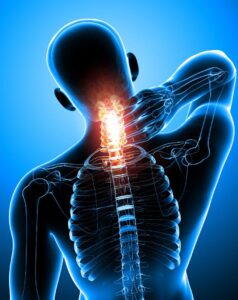 Whiplash pain in Coventry and the Midlands