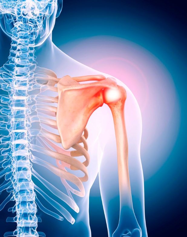 Shoulder pain in Coventry and the Midlands